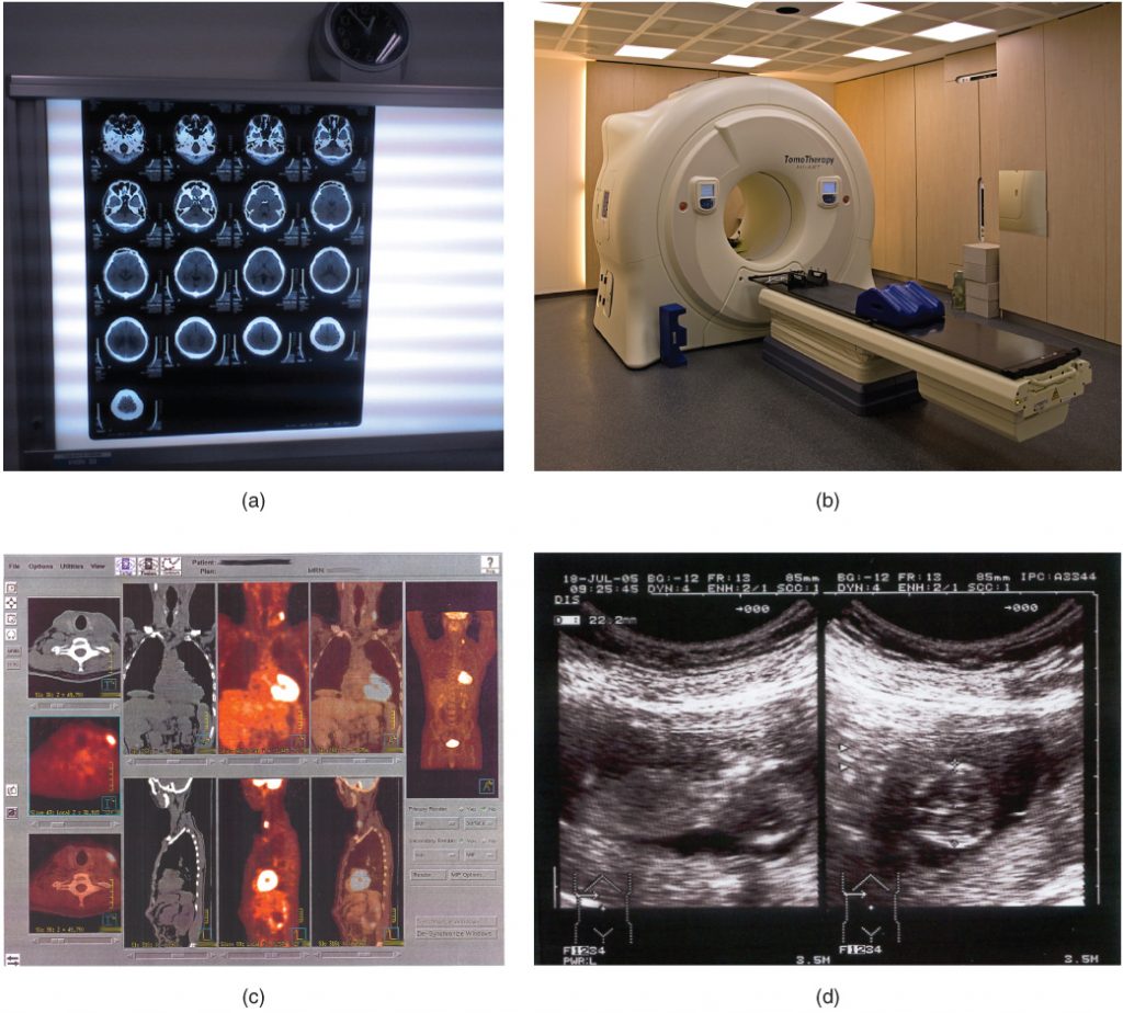Modern Imaging Modalities