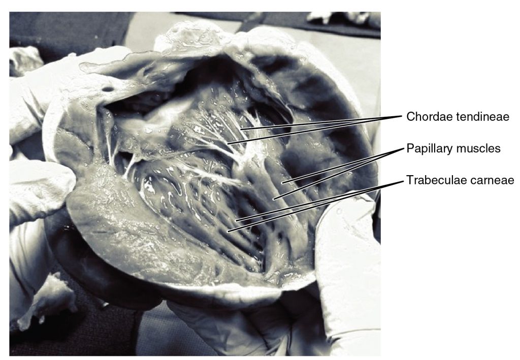 Chordae Tendineae and Papillary Muscles