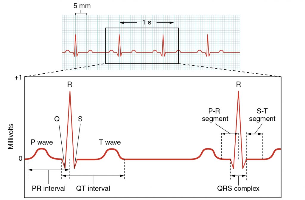 Electrocardiogram