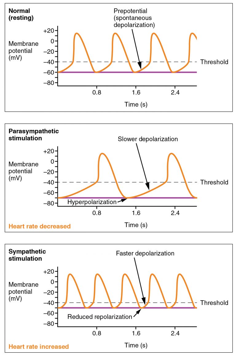 Effects of Parasympathetic and Sympathetic Stimulation on Normal Sinus Rhythm