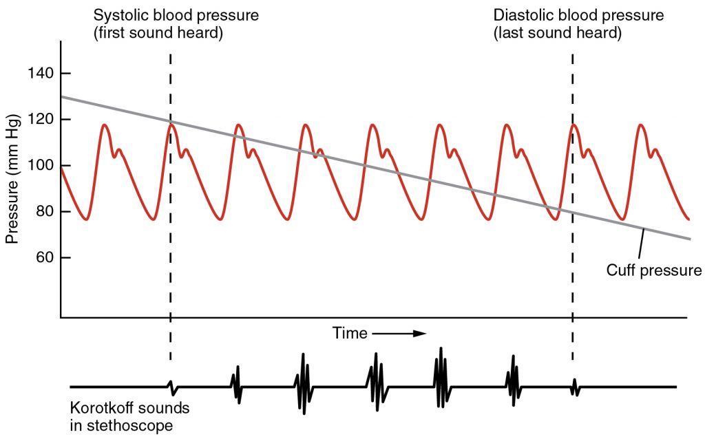 Blood Pressure Measurement