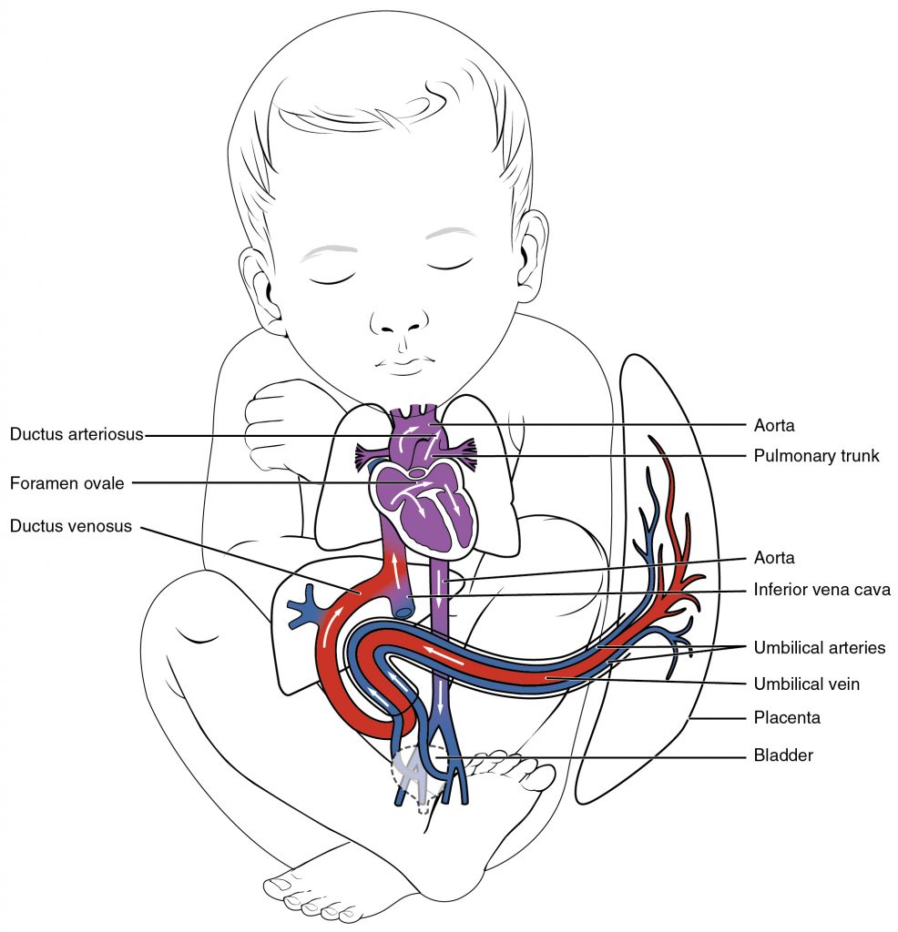 Fetal Shunts