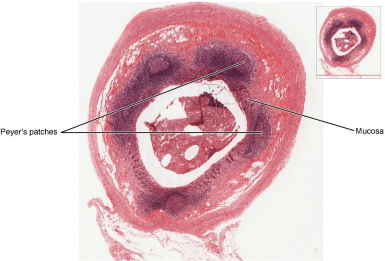 Locations and Histology of the Tonsils