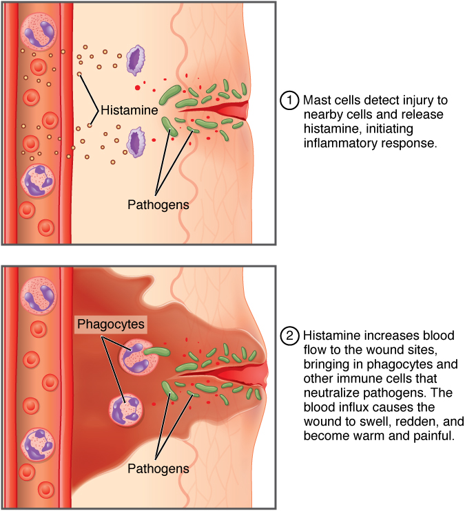 Inflammatory Response