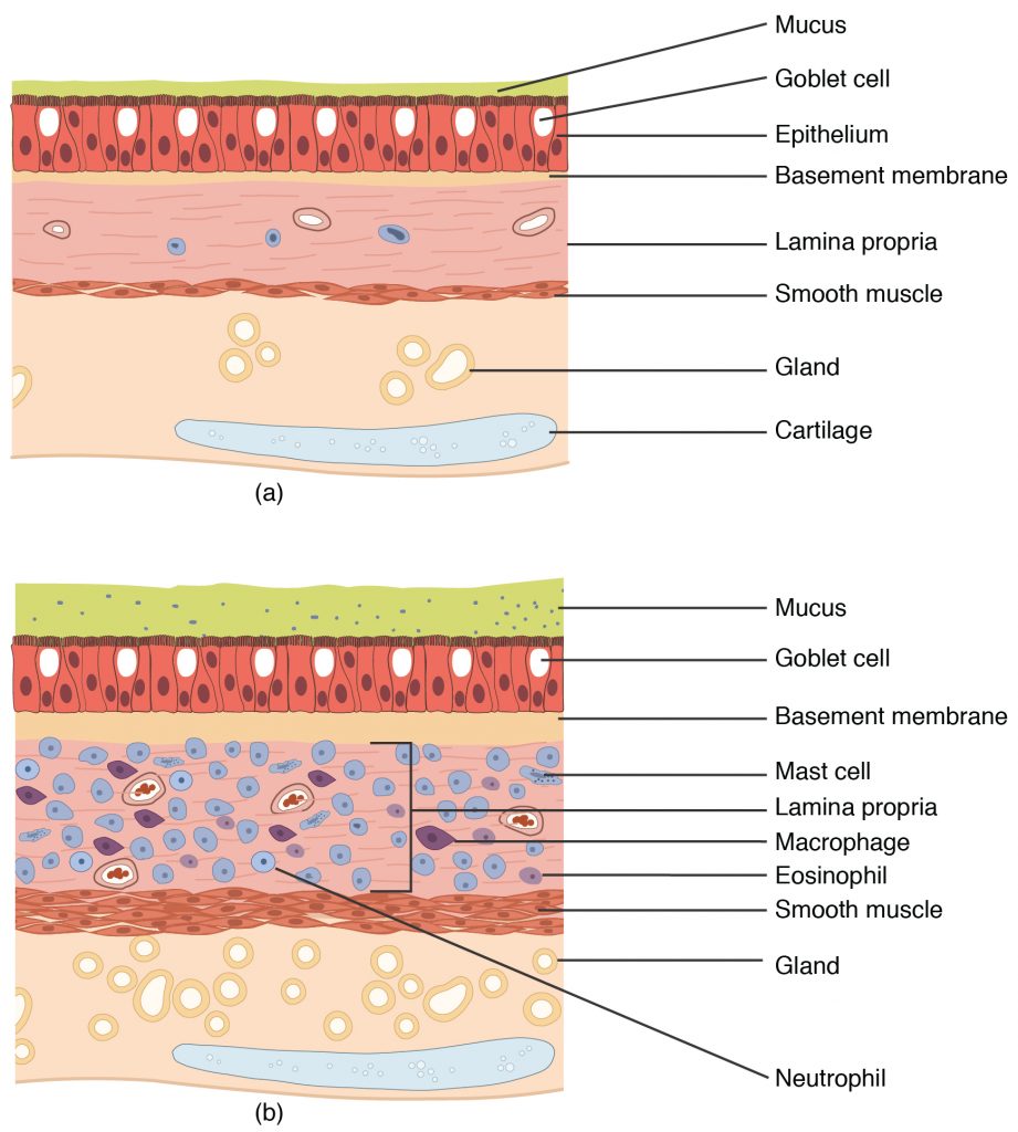 Normal and Bronchial Asthma Tissues