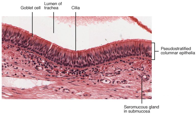 Pseudostratified Ciliated Columnar Epithelium