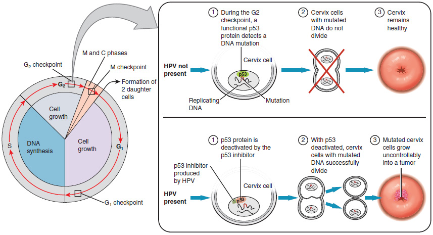 Development of Cervical Cancer