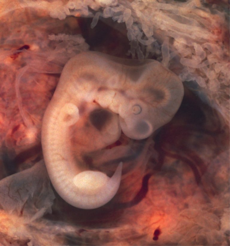 Embryo at 7 Weeks