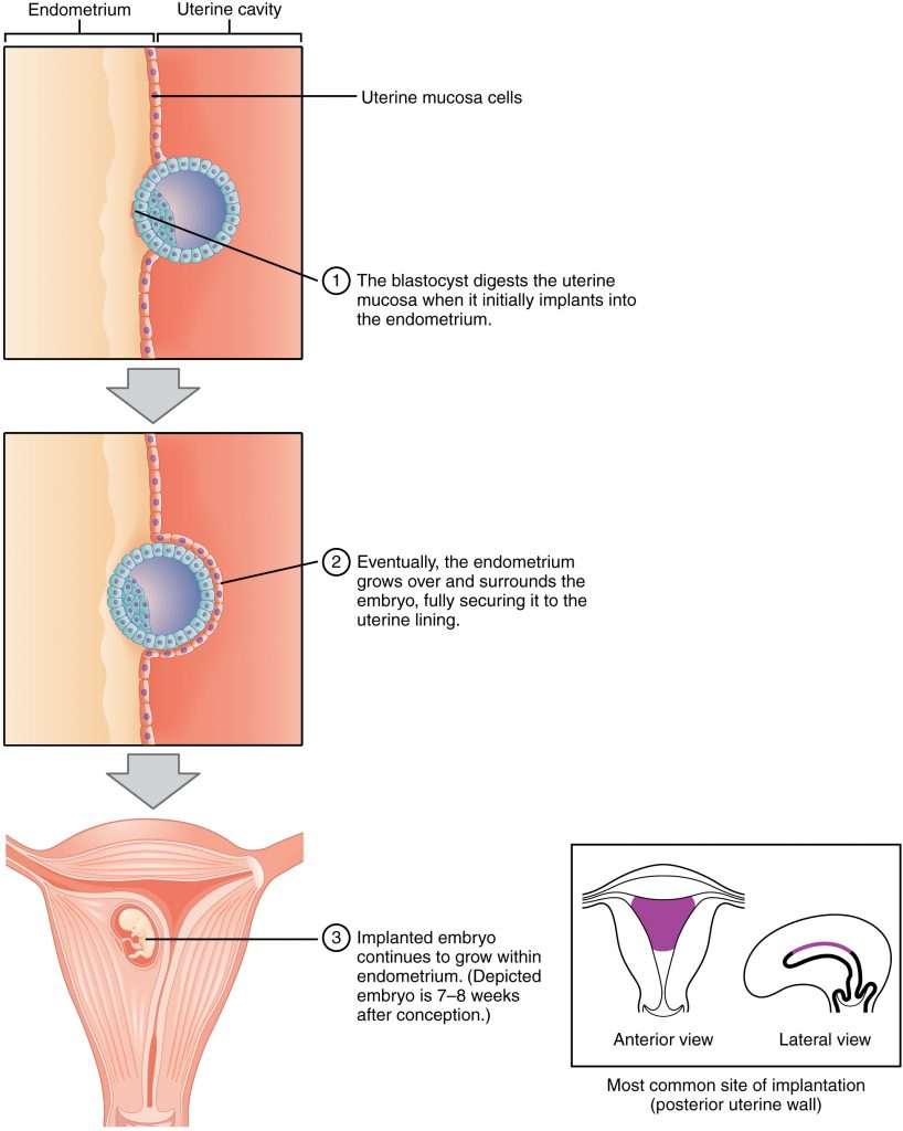 Implantation