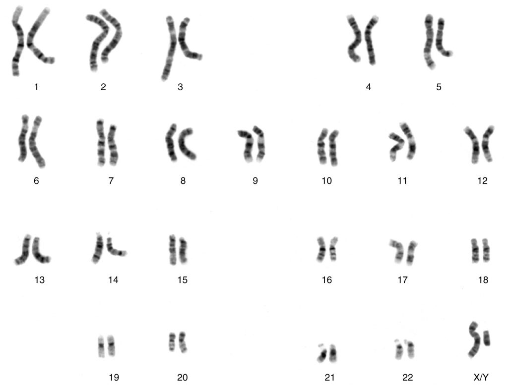 Chromosomal Complement of a Male