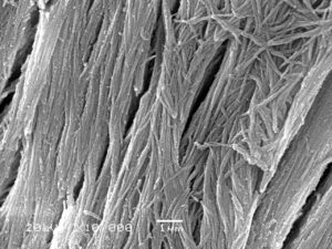 Calcified collagen fibers