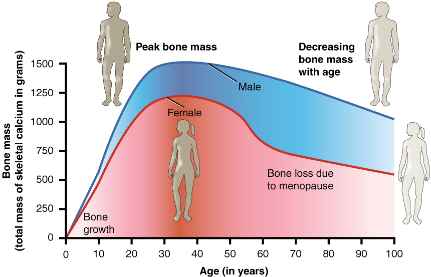 Graph Showing Relationship Between Age and Bone Mass